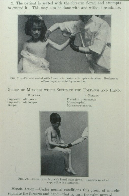 Treatment demonstration from page in book Treatment demonstration